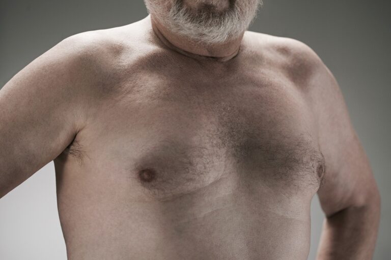 old white beard man chest growth